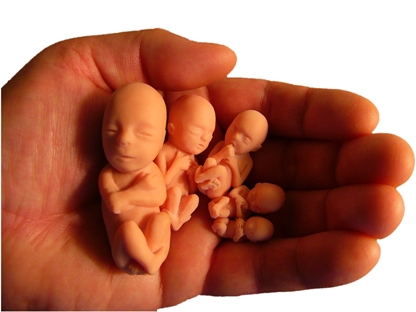 Hiruški abortus