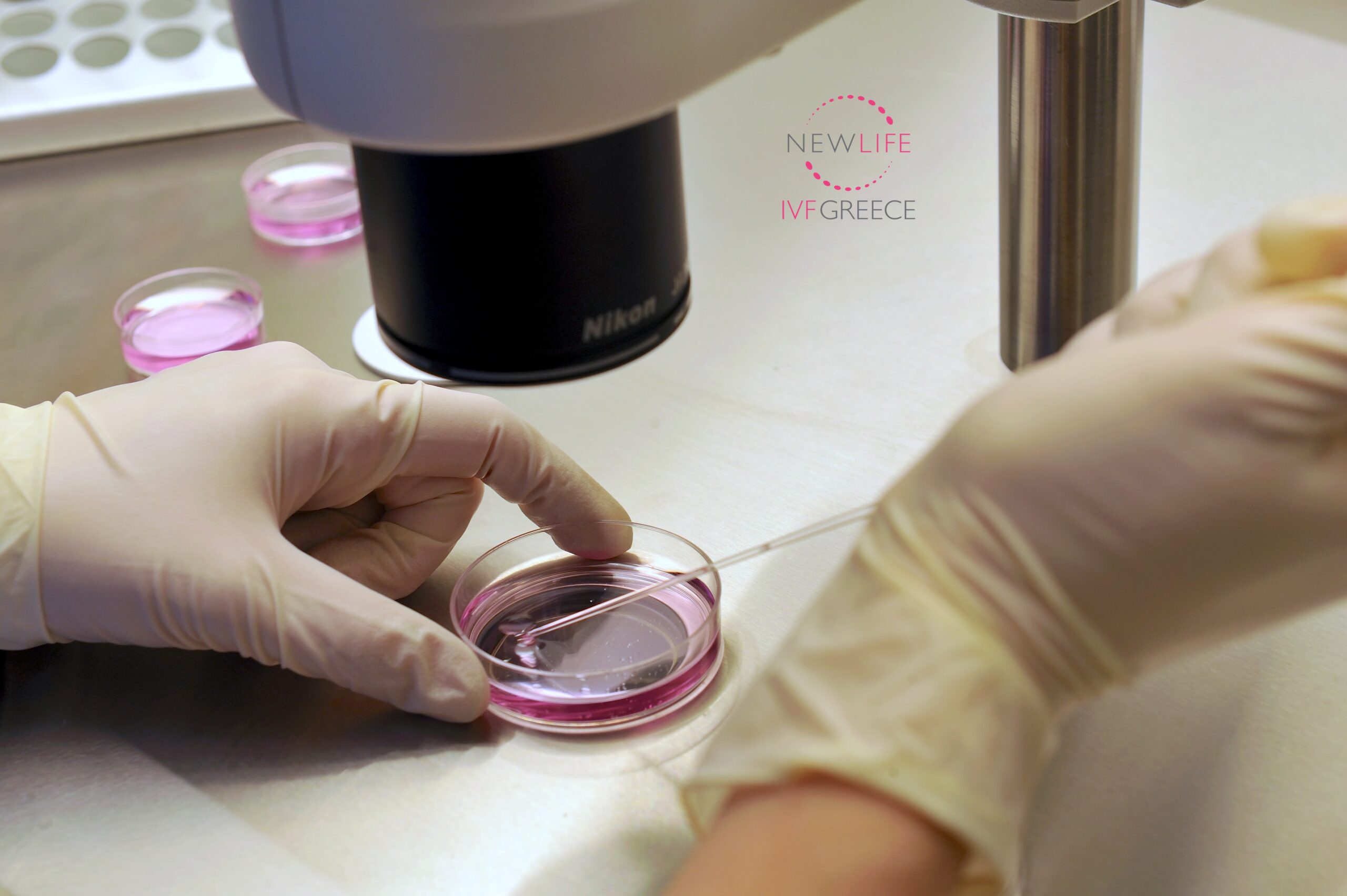 Kako vantelesna oplodnja izgleda u klinici Newlife IVF Greece