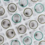 neinvanzivni prenatalni test