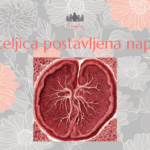 Posteljica postavljena napred