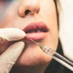 estetske procedure tokom dojenja