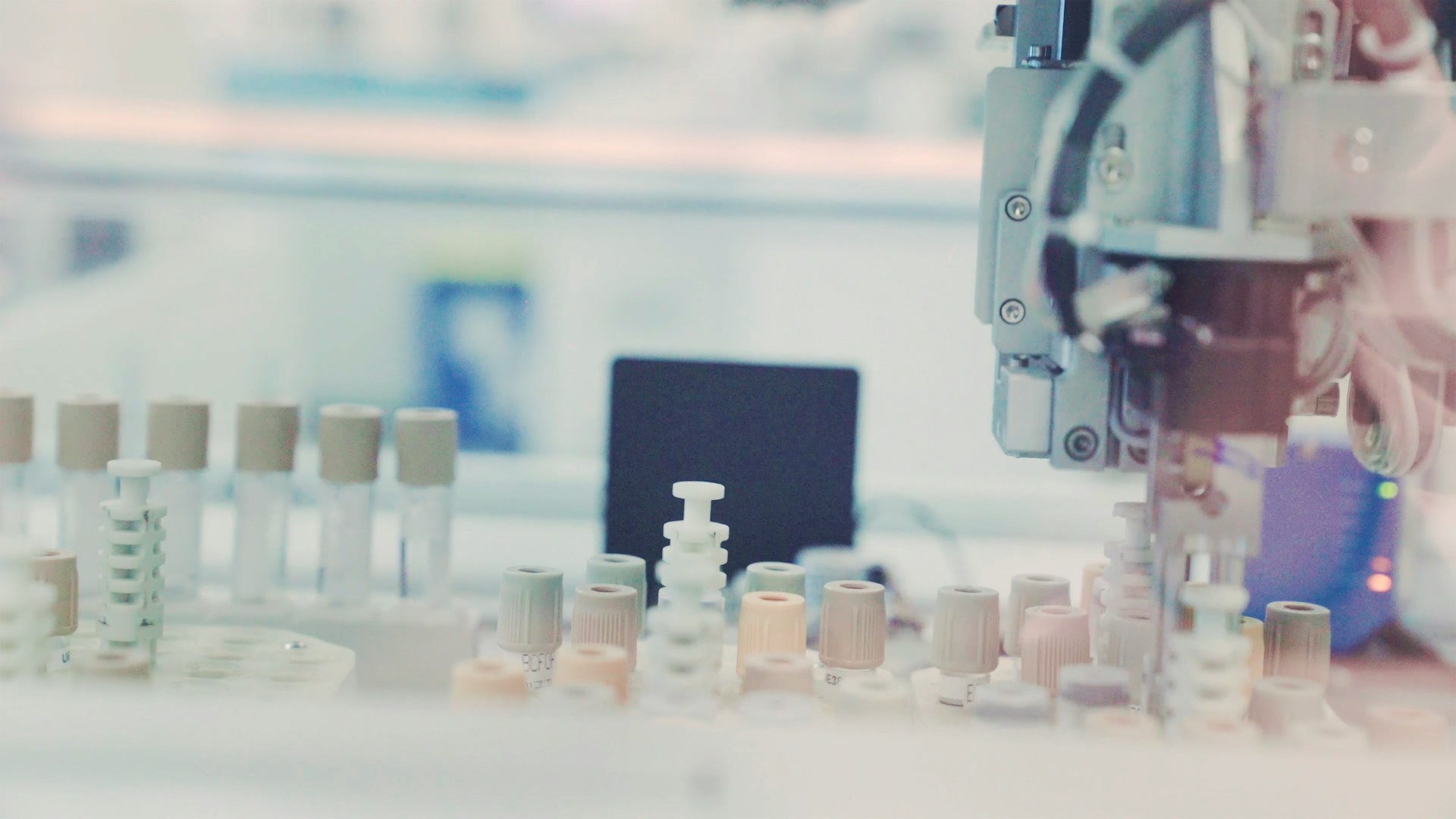 biopsija horionskih čupica horiocenteza