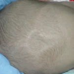 Fontanela