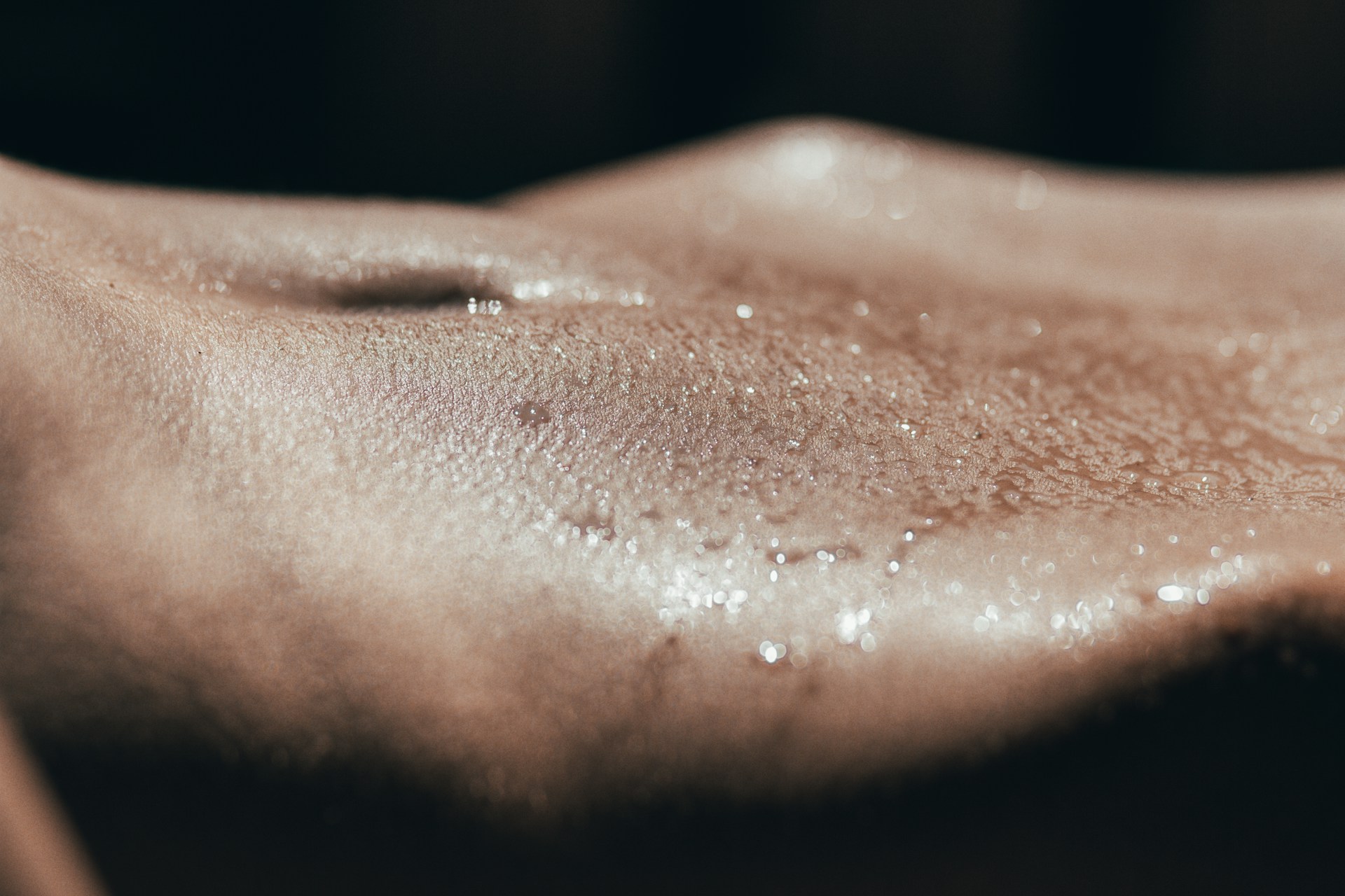 znojenje na preponama