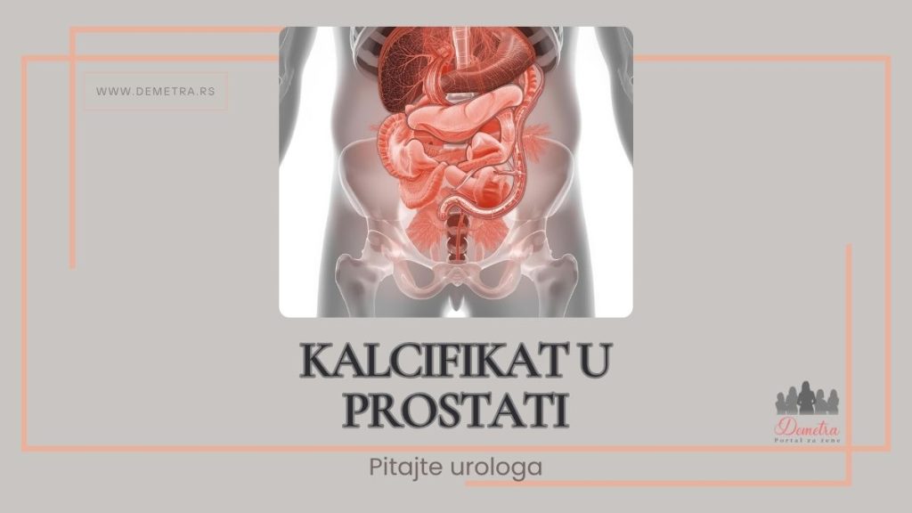 kalcifikat u prostati