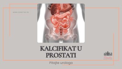 kalcifikat u prostati