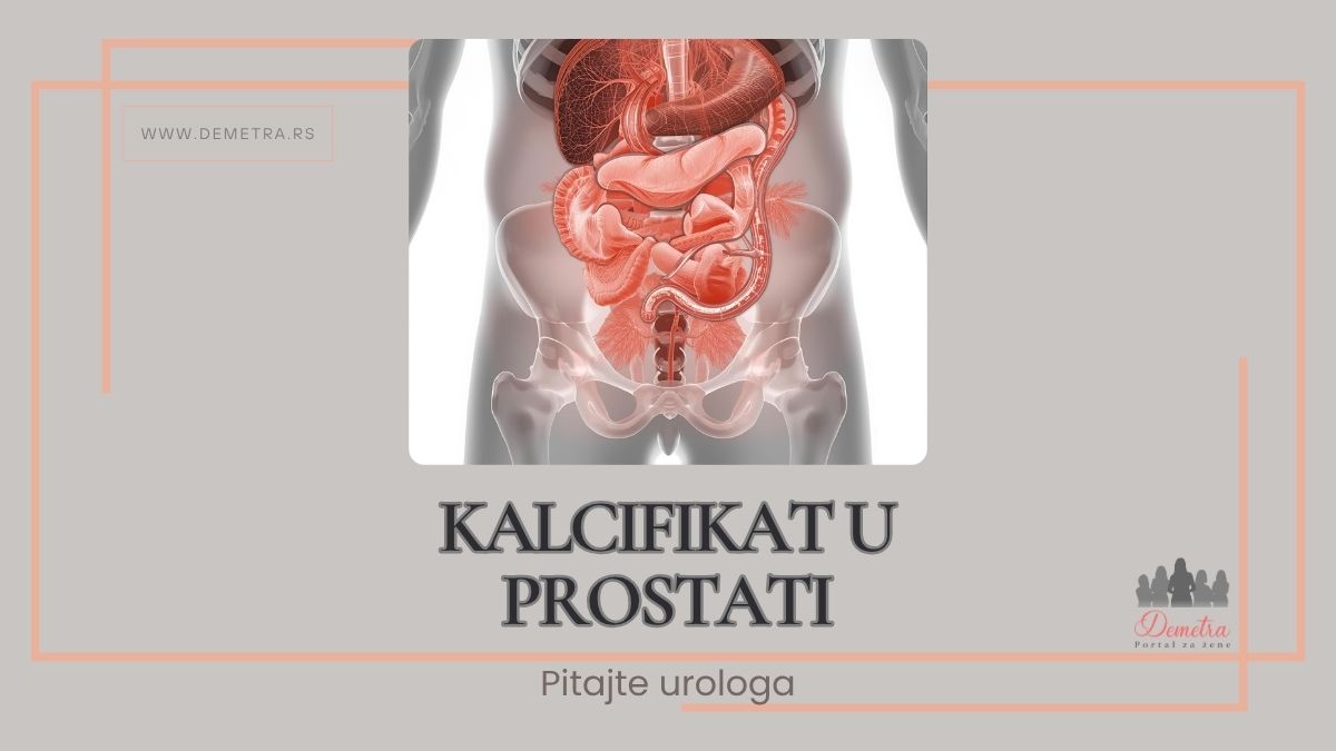 kalcifikat u prostati