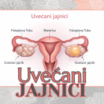 UVEĆANI JAJNICI