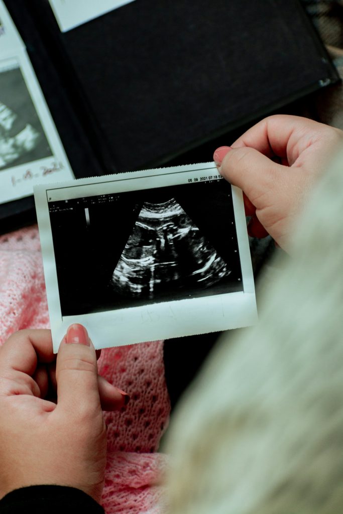 Kako odabrati ginekologa za trudnoću