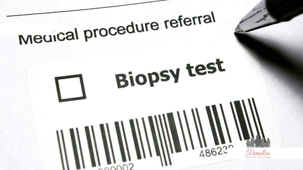 biopsija
