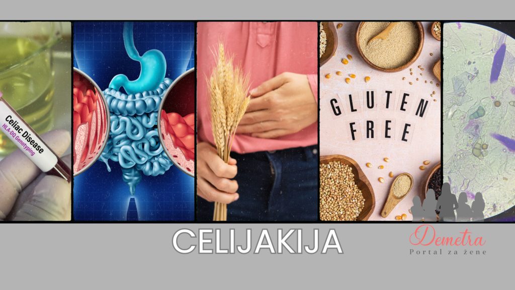 CELIJAKIJA KATEGORIJA